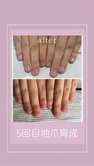 💎最強のネイルケア💎(地爪育成)モデルコース(8回)