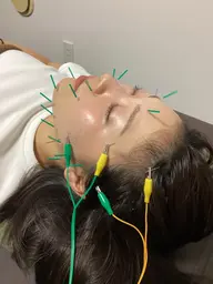 3月限定《美容鍼＋整体》選べる施術つき90分コース