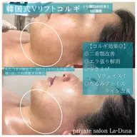 韓国式小顔ソフトコルギ🇰🇷【Ｖリフトコルギ×EMS/LED照射】小顔はコレで決まり❣️韓国式で本格揉み上げコルギ✨