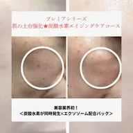 肌の土台強化★炭酸水素エイジングケアメニュー