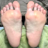 フット角質ケア単品