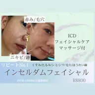 【限定3名様】韓国整形級🇰🇷インセルダムフェイシャル自分史上ワンランク上美肌へ✨🌿商品相談ももちろん可能💭