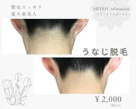 【後ろ姿美人】うなじ脱毛