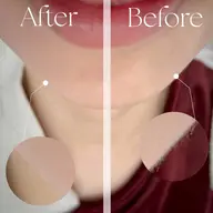 🌼フェイシャルワックスで今まで見たことのない素肌へ🌼9000円→6000円（1100円オプションパック付💆‍♀️）