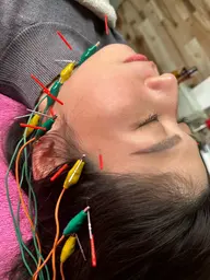 ✨ミニモ限定✨ 美容鍼コース フェイスライン約30本お試し 50分 メンズも大歓迎 通常10,000円⇒8,000円