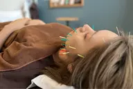 美容鍼（スペシャル）・首肩ヘッドマッサージ付