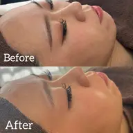 顔剃り+うなじ剃り