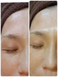 【女性限定】毛穴つるん・透明感UP・小顔印象へ!肌リズムケア&むくみ流し付き(70分)