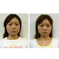 【新規】小顔矯正ベーシックコース/むくみ、たるみ　◆￥11,600 → ￥4,980現金限定