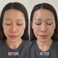 韓国ツヤ肌❤️‍🔥SNOW PEEL✖️LHA SHOT