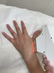 【平日限定】【IPL脱毛】 腕全体・指甲〜上腕脱毛