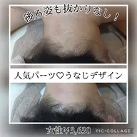 【女性】ブラジリアンワックス(VIO)+うなじ9,680円