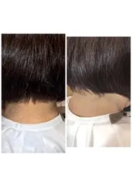 ご新規様限定　中学生脱毛　全身　女性のみ　VIOと顔無し　　通常￥8800→￥5500