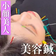 眼精疲労美容鍼👀【電気容鍼🦔】お顔全体の血流up⤴️✨《口コミ投稿で¥500オフ🍃》