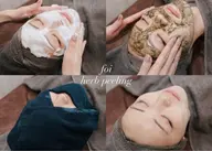 80％OFF‼️剥離なしハーブピーリング🌿【初回限定価格】ニキビ・毛穴悩みを根本改善🩵