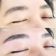 ハリウッドブロウリフト