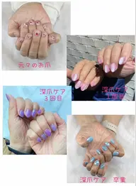 深爪ケア（ワンカラー）　モニター募集