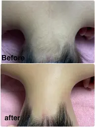 【脇・うなじ・背中上】後ろ姿美人💖前撮り・ウエディング・卒業式・入学式・ドレスなど💗イベント前に人気