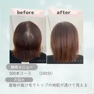 【新規限定】しっかり実感500本コース✨通常¥22,000