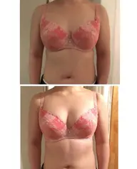 なにがなんでも！バストアップ！初回体験