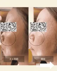 体験ブライトニングエステ💎