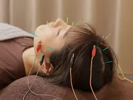 【U24限定◎】  電気美容鍼