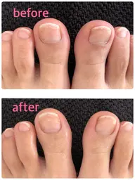 ⭐️1日1名限定⭐️フットバス付き!フットケア