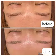 【2回目以降の方へ✨️】眉毛ワックス脱毛