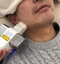 【💡メンズ限定💡】ヒゲ脱毛