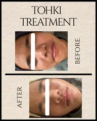 【REVI 陶肌トリートメント】削らず育てて、つるんと透明肌へ🫧はじめての陶肌体験におすすめ◎