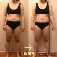 【モニター様回数券】🔥最強🔥体質改善❗️全身脂肪融解+造顔フェイシャル１５０分     3・6・9回数券