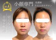 【結果重視!】お悩みにしっかりアプローチするならこれ!お得なフルコース2回施術セット◆