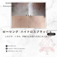 ニキビ知らず!!2回分!!話題のツルツル肌←ピーリング×ハイドロスプラッシュ