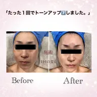 フェイシャルマッサージ