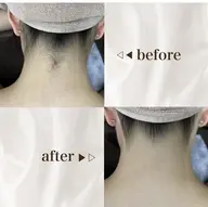 【ミニモ限定】大人気🔥うなじ脱毛シェービング付き