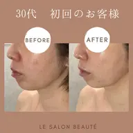 【話題のヒト幹細胞エイジングケア】大人女性におすすめ！まずはお試しください♪ドライヘッドケア付き