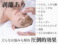 【頑固なニキビ・ニキビ跡・シワ】〈剥離あり〉リベルハーブピーリング🌿凸凹肌の改善や年齢肌、どんなお悩みにも◎