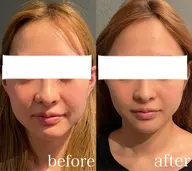 【今だけ限定低価格‼️オススメ❤️🔥】小顔コルギコース 14000円→7000円