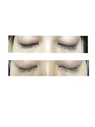 まつげ育成🤩ラッシュアディクト【荻窪/西荻窪】