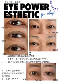 【いつまでも綺麗なまつ毛】アイパワーエステ+まつ毛パーマ通常17160円▶︎14500円