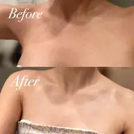 REVIハーブピーリング デコルテ