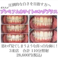 【超お得】プレミアムホワイトニングプラス 3来店計110分照射 短期集中ホワイトニングケアに🦷✨