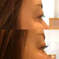 パリジェンヌラッシュリフト