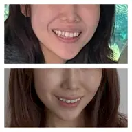 表情筋トレーニング レッスン体験モニター