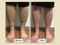 最先端よもぎ蒸し＋美脚ケア80分¥9,800→¥6,800