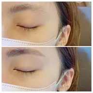 眉ワックス脱毛