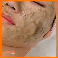 ★18 ハーブピーリング(剥離)Lv.2　90分 28000円→75％off