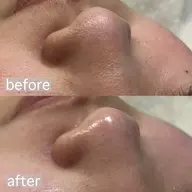 🫧minimo価格🫧フェイシャルワックス＋モデリングパックで鎮静保湿ケア🌿