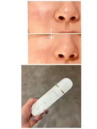 10名限定‼️お顔のウォーターピーリングでお顔の皮脂汚れを落とし、トーンアップ、ツルツル肌へ‼️保湿パック付き