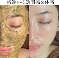 【リピ率No.1】ハーブピーリングで肌質改善＋専用美容液導入